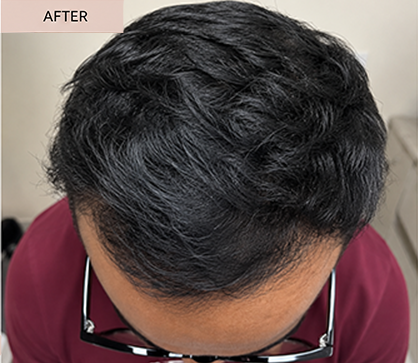HAIR 2 AFTER